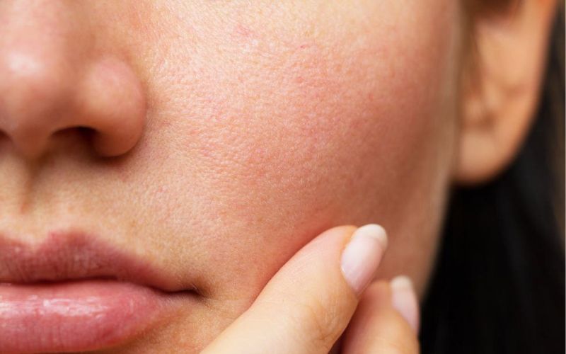 Kem dưỡng It's Skin giúp giảm tình trạng bong tróc da