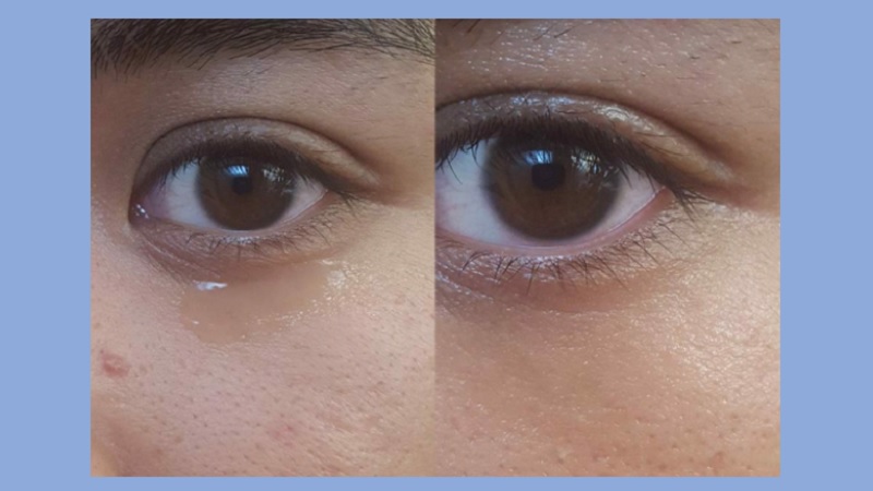 Hướng dẫn sử dụng kem dưỡng mắt It's skin Hyaluronic Acid Moisture Eye Cream